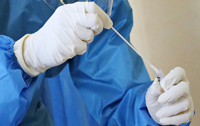 Роспотребнадзор сообщил об отсутствии случаев завоза вируса Нипах в Россию