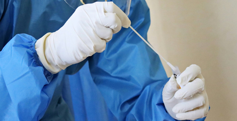 Роспотребнадзор сообщил об отсутствии случаев завоза вируса Нипах в Россию