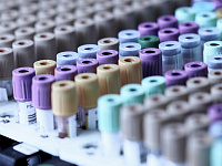 ГД ограничила передачу генетических данных россиян за рубеж