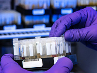 Анализ на ВПЧ включили в программу ОМС для женщин