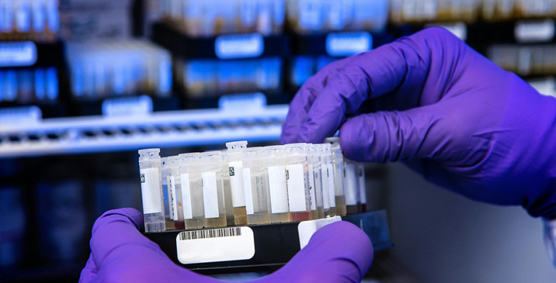 Анализ на ВПЧ включили в программу ОМС для женщин