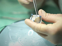 В Кузбассе открыли завод по производству биопротезов клапанов сердца