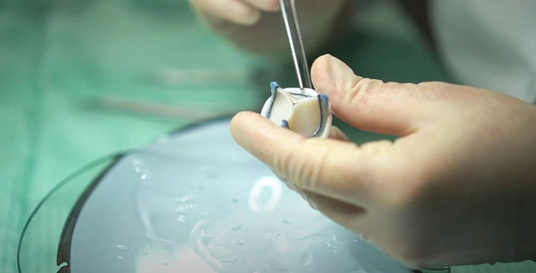 В Кузбассе открыли завод по производству биопротезов клапанов сердца