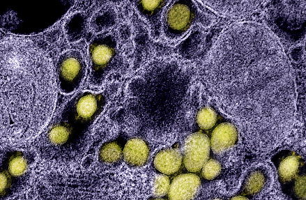 Вирус иммуноинтеллекта