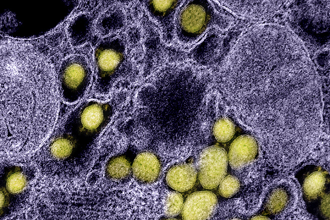 Вирус иммуноинтеллекта