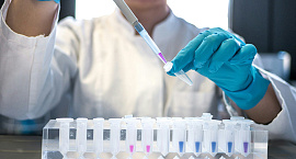 Россельхознадзор сообщил об опасном веществе в твороге «Савушкин продукт»