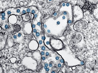 Эфиопия подтвердилa первую вспышку вирусной инфекции Марбург
