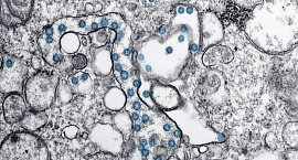 Эфиопия подтвердилa первую вспышку вирусной инфекции Марбург