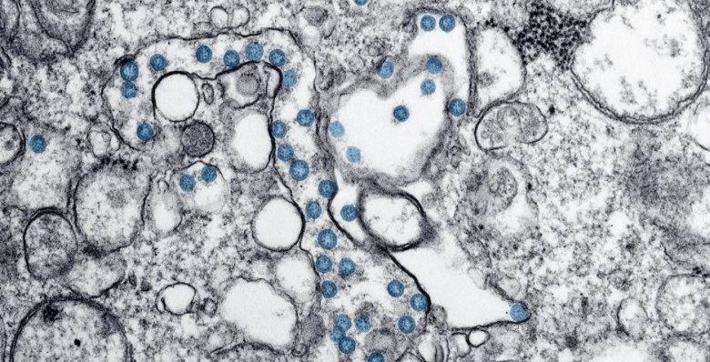 Эфиопия подтвердилa первую вспышку вирусной инфекции Марбург