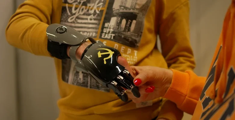 Пострадавшему при взрыве в Красногорске мальчику установили протез руки